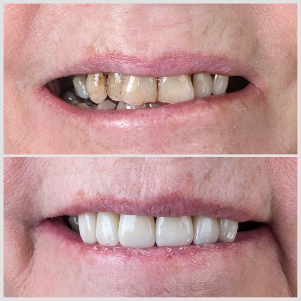 Marlton Modern Dentistry | About us