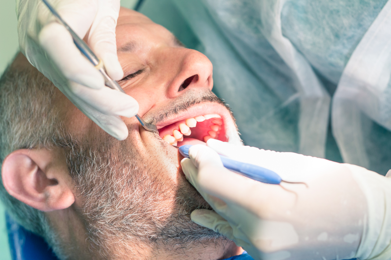 Root Canal Therapy in Marlton, NJ: When Saving Your Natural Tooth May Be Possible Root Canal Therapy in Marlton, NJ: When Saving Your Natural Tooth May Be Possible